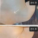청담피부관리샾