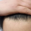 성지약국 | 종로 탈모 성지 처방받아 저렴한 약국까지 다녀온 후기