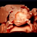 경선산부인과의원 | 대구 김건우산부인과 21주 중기정밀초음파 후기