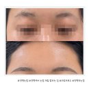 라뷰브로우