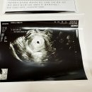 두줄찬방