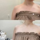 예봄인테리어 | 평택 팔뚝 승모근 관리 예봄뷰티 :: 보정X 아이폰 기본카메라 후기