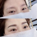 에이브로우 이미지