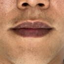 기림디자인 | 검은 입술 고민 끝! "강남남자입술문신" 1차 탈각 후기부터 2차 리터치 완성까지(각질탈각,리터치꿀팁)