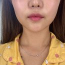 고은피부만들기 | [고은콜라겐] 판교피부관리, 근막부터 잡아주는 소녀윤곽테라피 후기 !