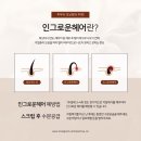 온 왁싱 이미지
