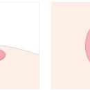 청담더유외과의원 이미지