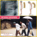 고려보조기 이미지