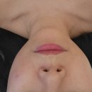 부천 윤곽관리 관리샵 편안한분위기의 피부관리실 신중동 보테에스테틱 내돈내산후기 (비포에프터사진있음)