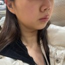 유어타임성형외과의원 | 소개팅주사 | 강남역 성형외과|이중턱 조지기.. |스테로이드 유무 차이