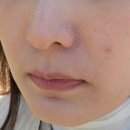 세븐일레븐 송도드림점 | 환절기 송도피부관리 올가드림뷰티 송도점