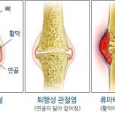 퇴행성 몸의 관절에 좋은 음식 이미지