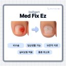 은평더맑은의원 | 은평구 구산동 내향성 발톱 치료 교정기로 통증 완화 효과 있을까?