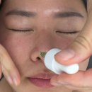 100프로스킨케어 | 방배피부관리 듀베로더스킨 알테온 모공 탄력 후기