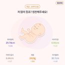 CU(부림점) | 임신 33주 - 역아 돌리기 , 태아위치 , 태아 몸무게 &amp; 크기