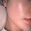 약초 | 여드름흉터 없애는 방법 삼덕동피부관리 솔에스테틱 약초필링 후기