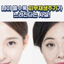 티투(T2) 이미지