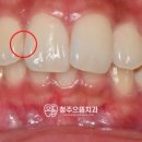 청주으뜸치과의원 이미지