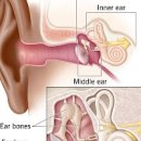 성인 중이염 원인 중이염 통증 이미지