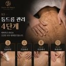 결혼 전 등드름관리, 방이동 에스테틱 원장이 직접 공개하는 핵심 기준과 후기