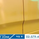 덴트존 이미지