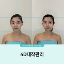 대작 | 광교 얼굴경락 고운빛깔 광교점 4D대작관리 후기