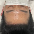 차밍헤어 | [공지] 충주 두피문신(smp)후기🤍| 차밍뷰티랩