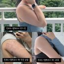 겁나 안빠지는 팔뚝살빼기 2탄 - 리베리의원 병점점 인모드+베리주사 팔뚝주사 내돈내산 찐후기