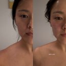 건강관리실 | 분당 비대칭 고민하다 찾은 성형경락 맛집 ㅣ 샬롬 건강피부관리실 후기