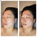 바른결 PT | 상왕십리 피부관리 결앤핏, 탄력 수분관리 맛집, 슈퍼젝션 잘하는 곳