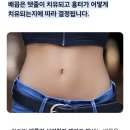 배꼽 모양으로 알아보는 당신의 평균 수명과 성격 성향 이미지