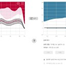 뉴이어보청기(대구센터) 네이버블로그