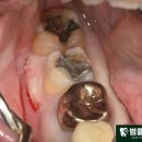 범플란트치과의원 이미지