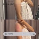 울산바디관리 여신뷰티에서 팔뚝슬리밍 받은 후기