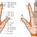수지침 이미지