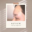 온누리파란약국 | 서울 자연스러운 이마필러 후기 가격, 통증 정도