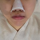 청주 피부관리 믈리에스킨 비하동 위치하고 토카막 관리 받았어요.