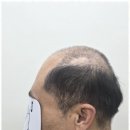 모앤도트 네이버블로그