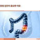 미사늘편한내과의원 | 미사역내과, 대장암 검진, 생명을 살리는 전략. 선별검사의 효과와 선택의 중요성