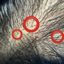 남문동물병원 | 수원 팔달구 남문 줄기세포 엑소좀 두피 케어 [SMP 스튜디오 본점] 3회차