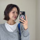 Hello멍 | 압구정ㅇㅁㄷ성형외과 비절개 자연유착 + 눈매교정 쌍수 한달차 솔직후기