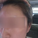 희헤어라인 | 구미 왁싱잘하는 희뷰티 헤어라인왁싱 후기