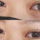 지우메디칼 이미지