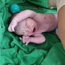 대덕대로-22 | 대전 모태산부인과 출산-유도분만 후 제왕절개 후기