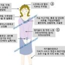 자율신경계 이상 증상 및 원인과 치료 : 자율신경실조증 이미지