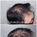 동명 남성 헤어 네이버블로그