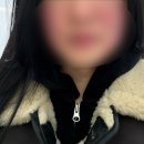 서울더원플러스치과의원 | 신사역 뷰컷플러스 맞고 온 당일! 붓기 정도와 시술 과정 상세 리뷰