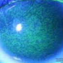 바른안과 이미지