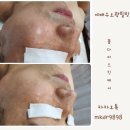 오광케어 이미지