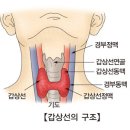 갑상선 수질암 이미지